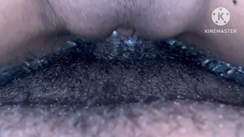 Peeda best aprasad: Inside Mouth