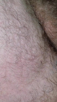 Assplay Solo Berbulu