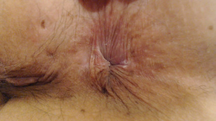 Abby Anna: Extrémní Zadek Hd Puckers