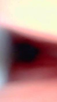 Endoscope Camera Captures Moment of Male Ejaculation 4K