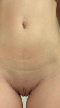 Skye Blue - Explicit Nudes Pt Ii