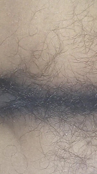 Toto natural, cur natural, anus natural