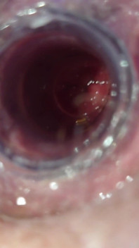 The Little Test with the Anal Tunnel
