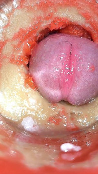 Kamera in Anal Gebärmutterhals, POV, Winziger Von Riesigem 'paar' Zum Cuckold Gemacht, Sperma in Anal Und Creampie - Asmr