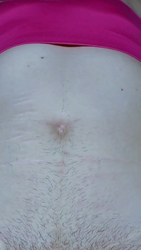 My Belly