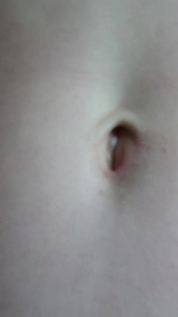 ท้องฉันกับรู navel