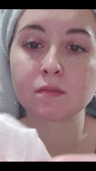 My ear cleaning routine starts with cotton swabs and then gauze.
