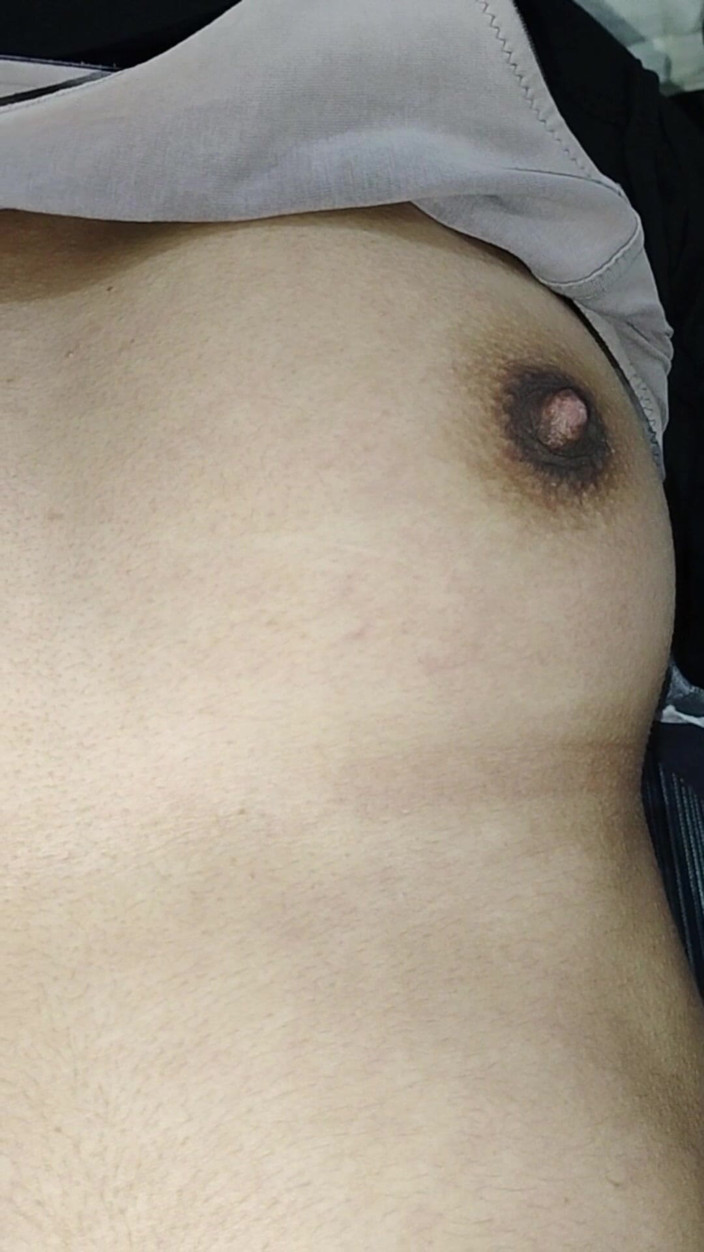 hot_couple_sex: Teen Girl Collage Girl Nude Video