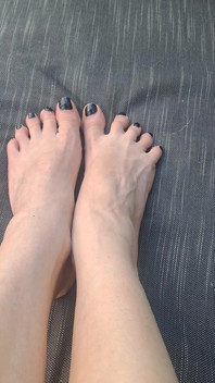 Do We See How Beguiled My Throbbing Foot Veins Are