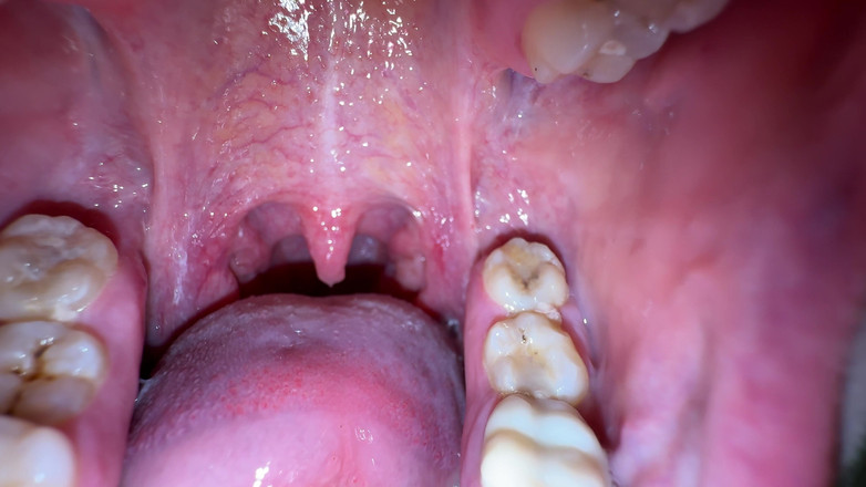 Hottie goddess: Ústa tajemství: tlustý bílý lak na mém jazyku