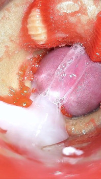 Cámara En Anal Cervix En Primer Plano, Pequeño Cornudo Por Una 'pareja' Gigante, Semen En Anal Y Preñada - Asmr