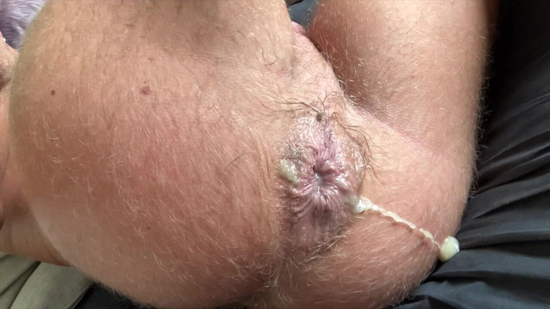 daniellandau: Выдавливание спермы, подборка 2