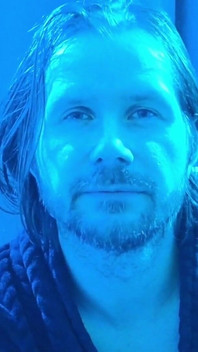 Albino Adonis - Neon Domination Mindfuck