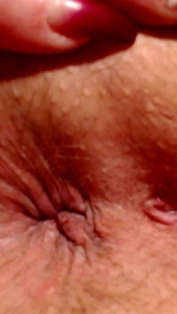 Butthole Winking ketat