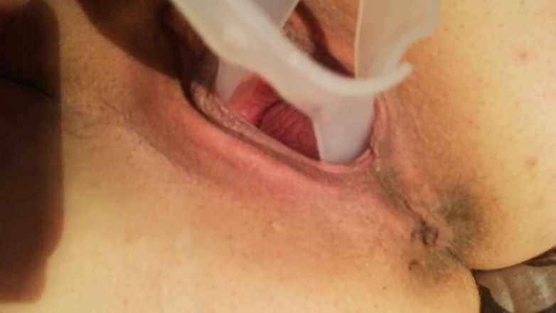 Putarankahotmilf: Speculum vaginale close-up