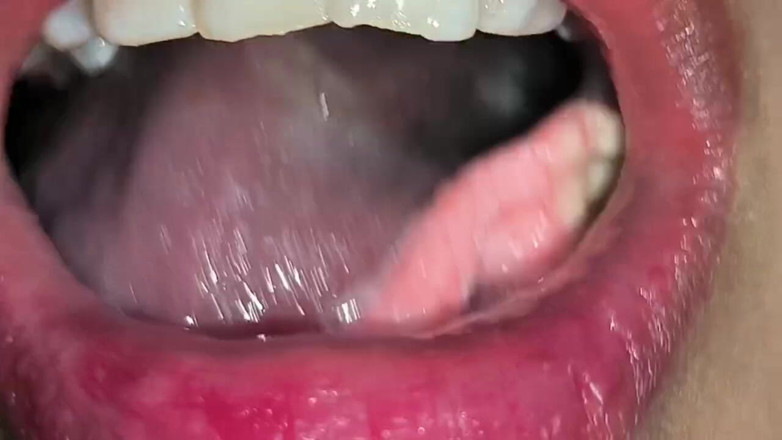 Isabel: Snake Gum