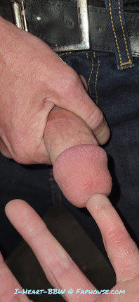 Gaping Urethra - Marker and Pinky Insertion