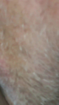 chaatna My Smacking anal rosette