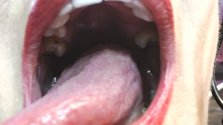 Abby Anna: Dentro de mi gran boca, úvula de dientes de lengua