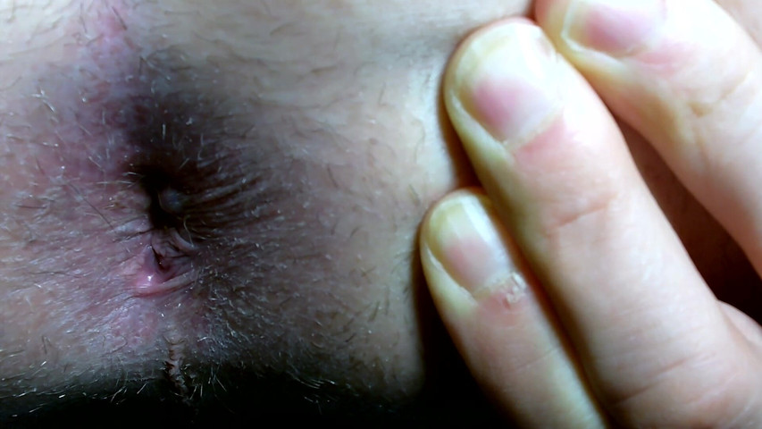 My Hole in Close-up (ItsMeSolo) My Hole in Close-up (ItsMeSolo)