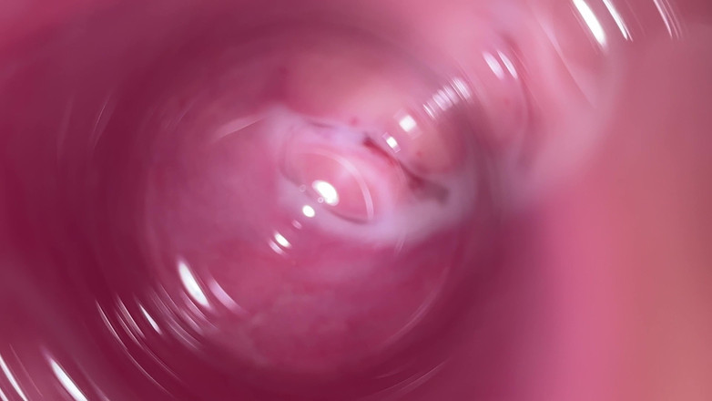 Kinky Mia: 摄像头深入 Mia 少女流白浆的阴户