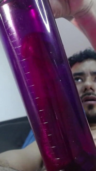 Penis Pump Pumping Foreskin Without Cutting