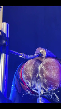 Gaping Creampied Butthole