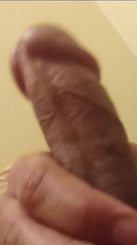 I Masturbated at Night and My Penis Started Leaking Water.