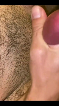 CBT Extreme Urethra Penis Insertion Cum