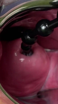 Crazywifeslut Cervix i Peehole Play
