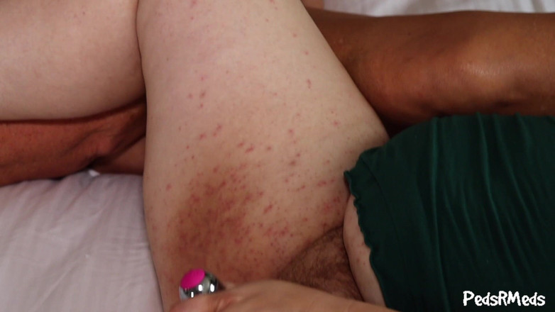 PedsRMeds: 숏리벳티어와 원더피트우먼 걸스 데이 파트 2