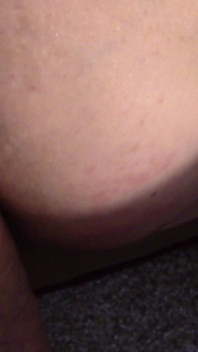 Anal POV