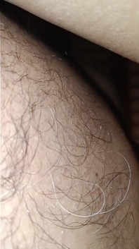 Parosan seksi kist buah dada besar