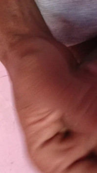 Small Penis