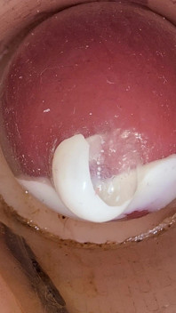 Camera din pizda adâncă înregistrează o ejaculare imensă de spermă în prezervativ