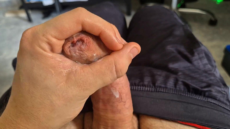 GloomyChase977: Phimosis Daddy. Kulup sekilas membelai sampai aku bocor di mana-mana