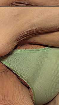 Mi hijastro no estará en casa, así que ponte en la cama y hagamos un video porno caliente con algunas vistas sexys de las aplaudidas de culo gordo