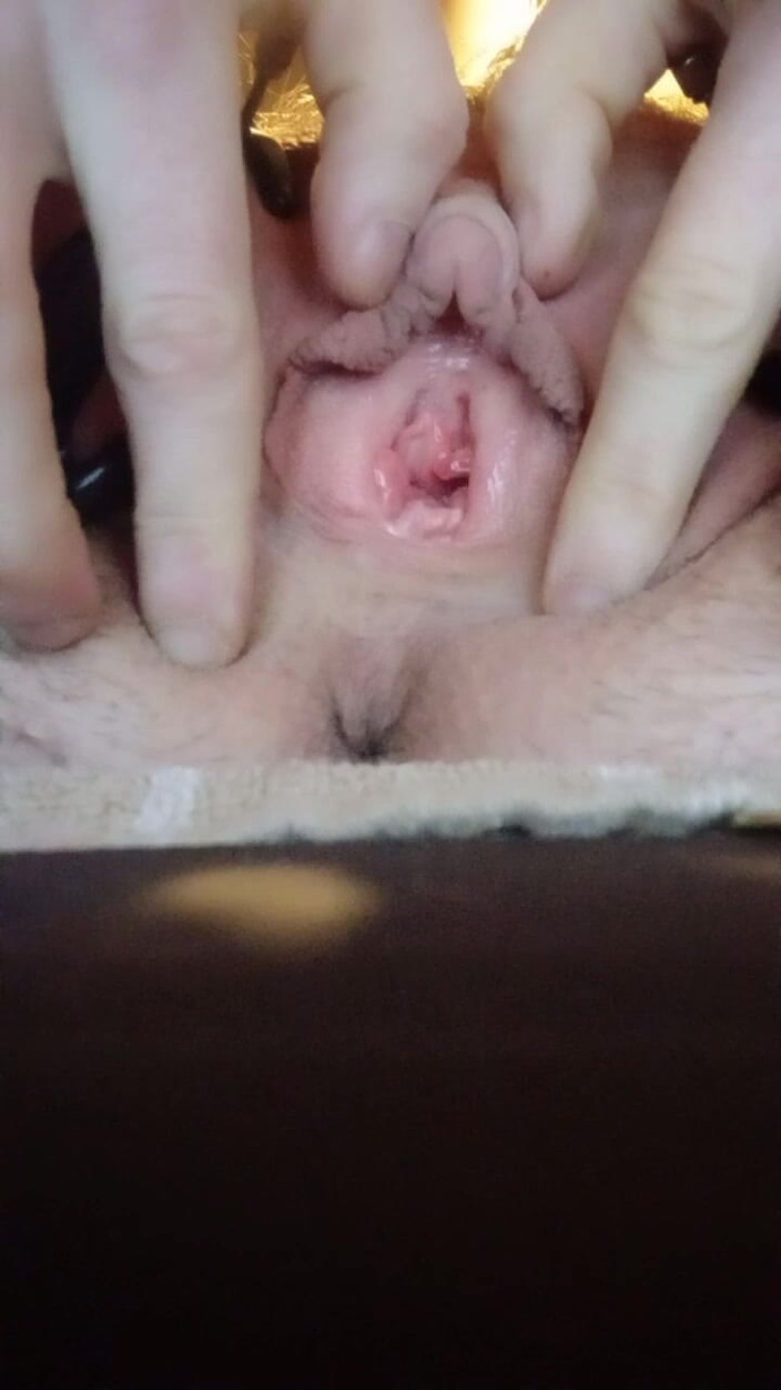 BonusholeToy: Ftm ukarał jodłę jako leniwą