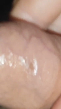 Un Pene Increíble, Único De Fimosis Resbaladizo Por Su Cuerpo Robusto.