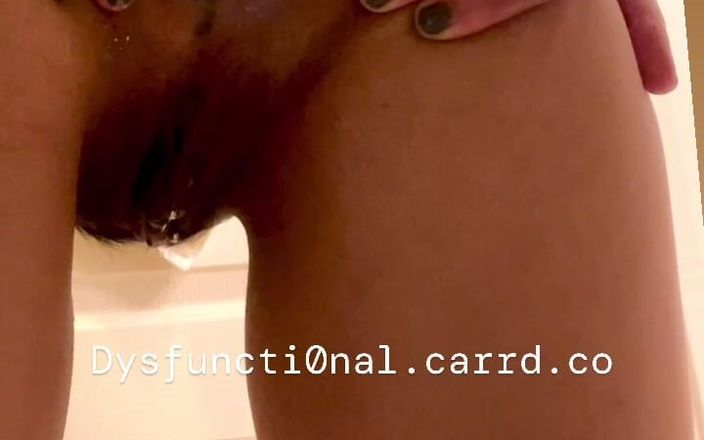 Dysfuncti0nal_s: Plym Olym anal fisting Ftm 1