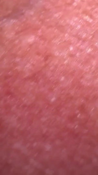 Macro skin no meu pau