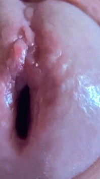 Wet Glans Hole Being Widened in Close up!