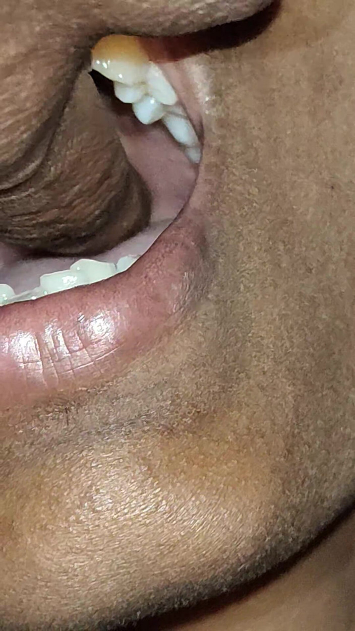 X videos: Adik tiri desi deepthroat