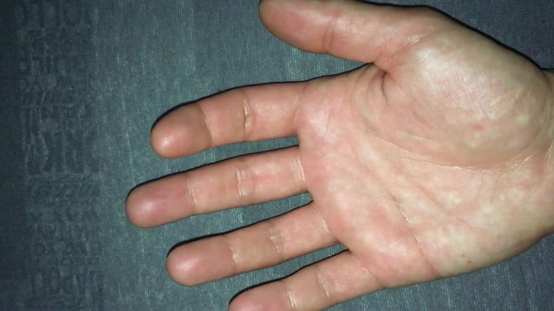 Idmir Sugary: Händer närbild, handflator närbild, spermasprut på båda händerna