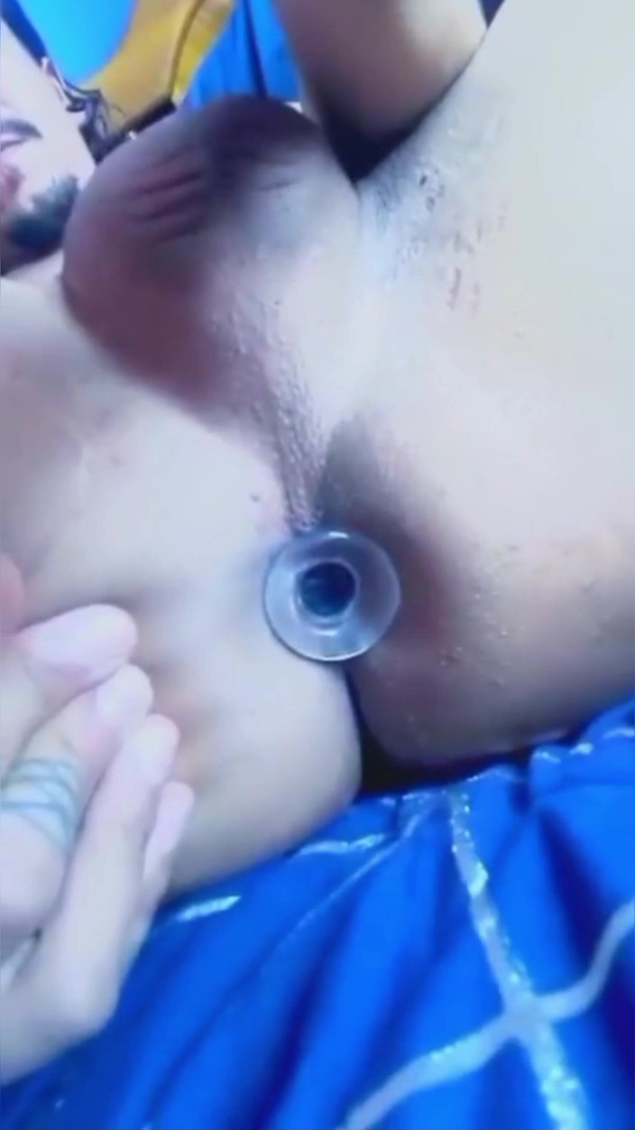 Arterotiko: Analstecker