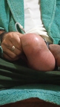 Saline in the Testicles