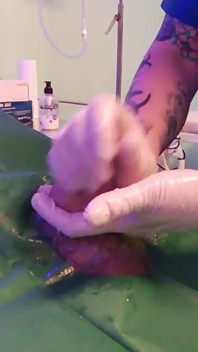 Medical Handjob