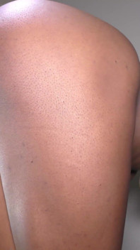 Une chatte noire ronde et étroite remplie de grosse bite blanche et d’éjaculation