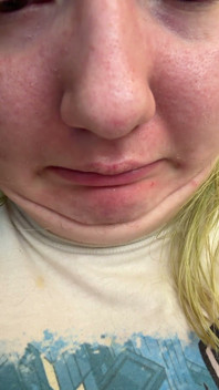 Chin Faces