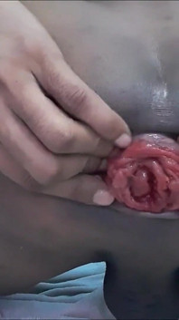 Nueng 97 T1 Hole Destruction Extreme, the Speculum